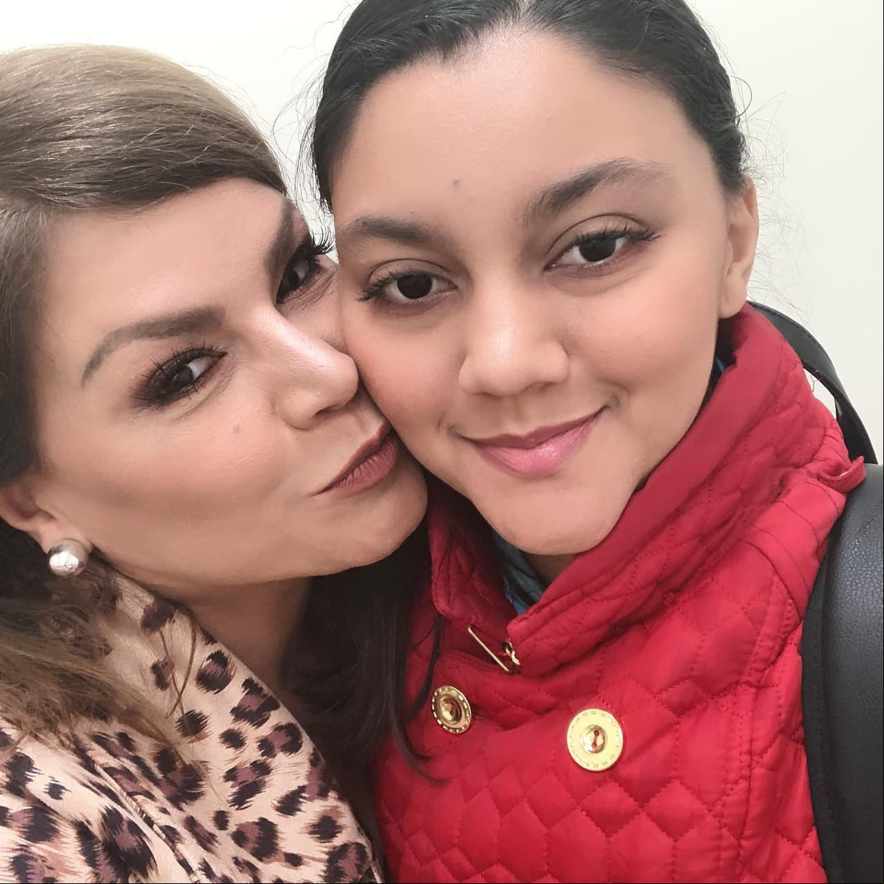Gabriella fue diagnosticada con una condición llamada anemia hemolítica.
