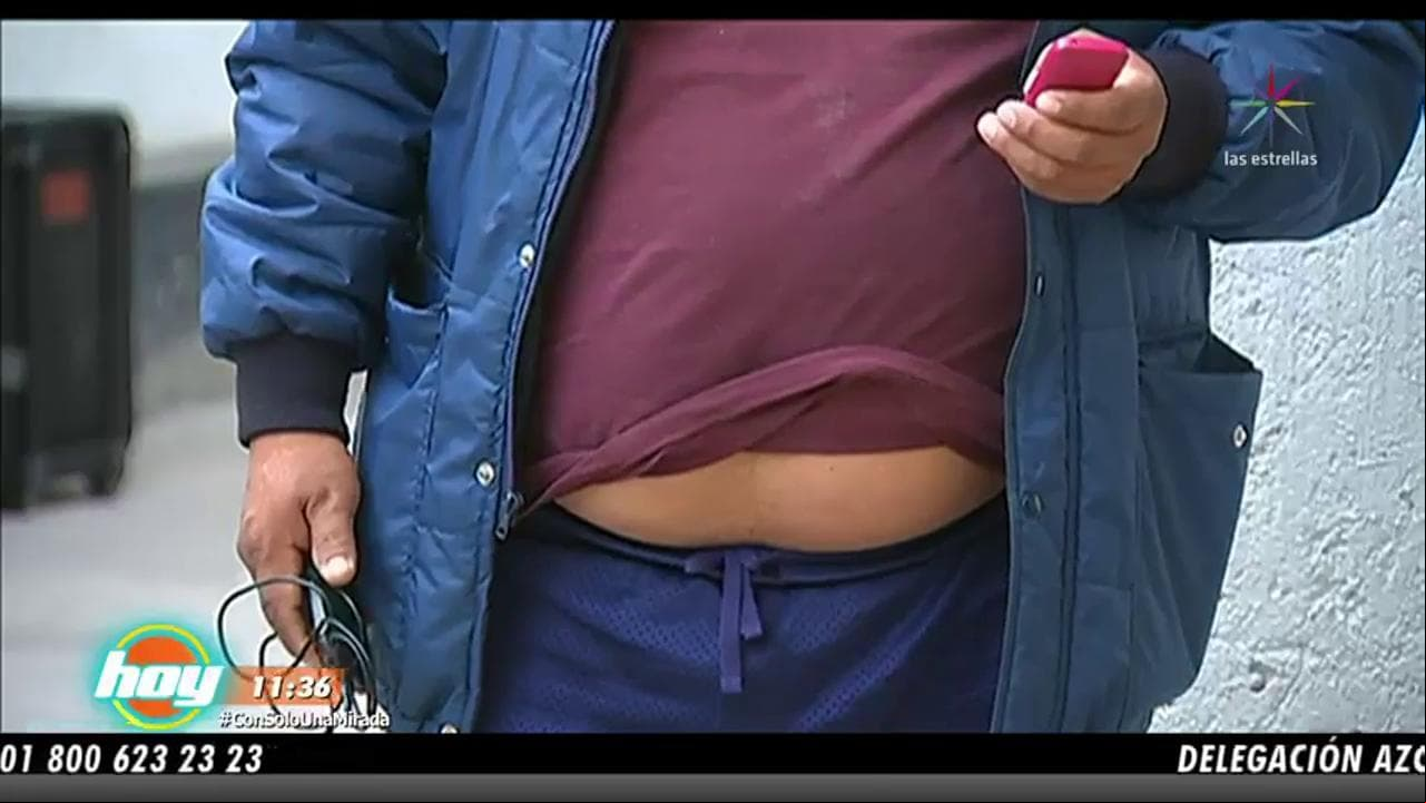 Descubre lo que no sabías de la obesidad y cómo prevenirla