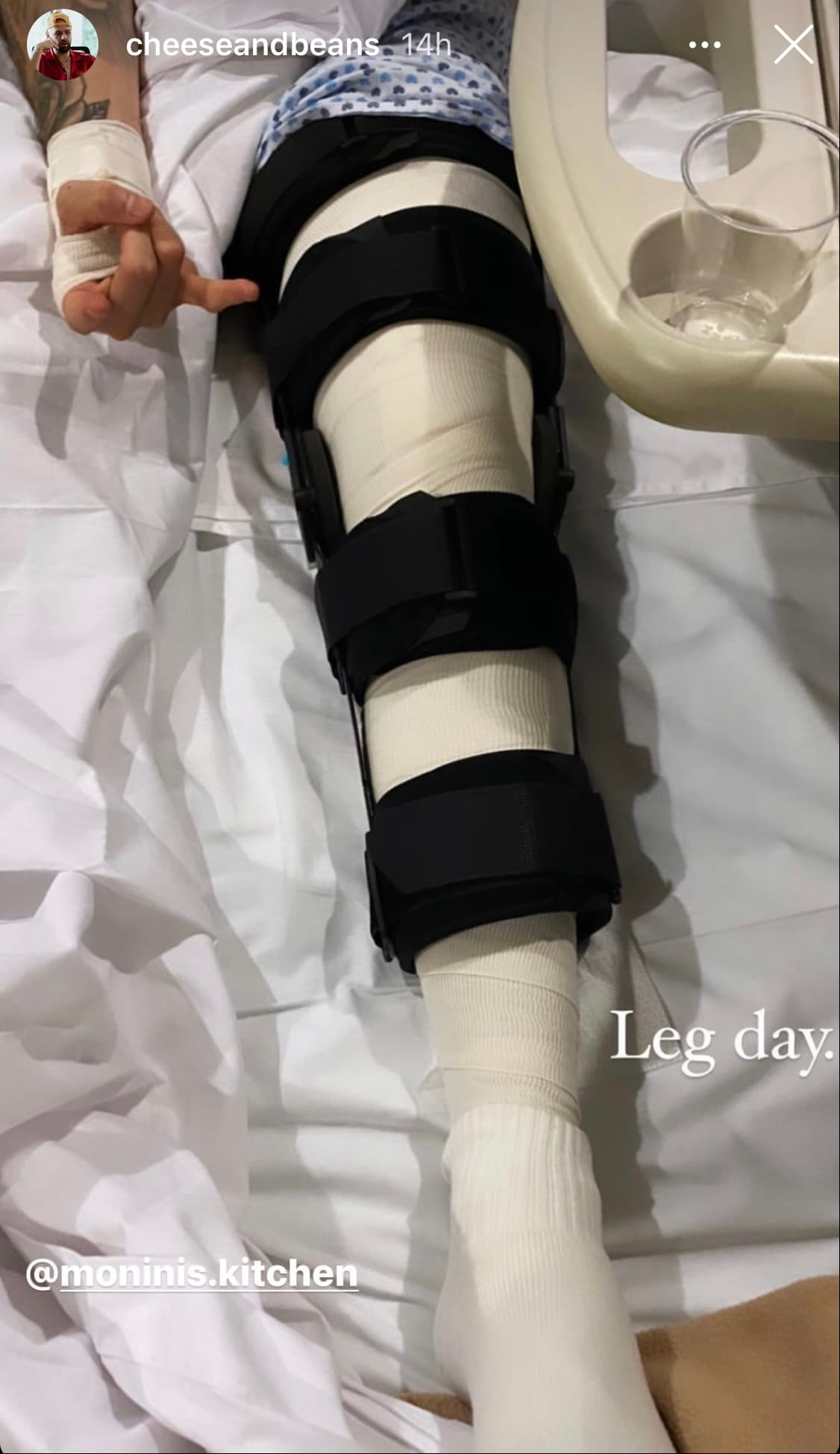 Jesse Huerta se encuentra recuperándose del accidente que sufrió
