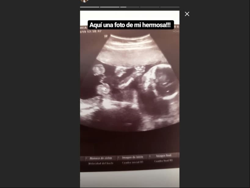 A mediados de agosto, la actriz compartió, a través de una historia en su cuenta de Instagram, una imagen de su ultrasonido, la cual acompañó con la frase: “aquí una foto de mi hermosa”.