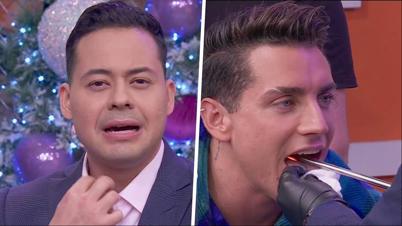 Agustín Fernández se hizo una revisión de las cuerdas vocales en vivo con una laringoscopia