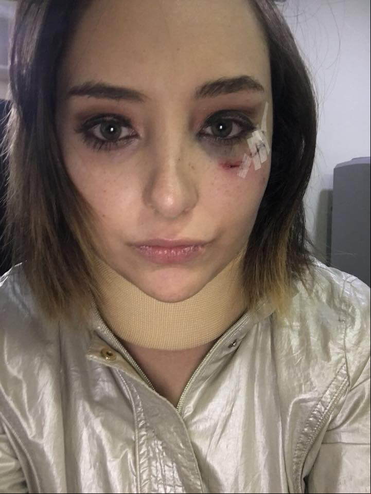 Vicedo compartió como luce después del supuesto altercado