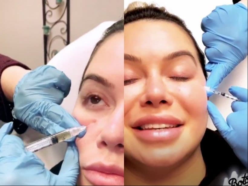 Chiquis Rivera se aplica Toxina Butulinica y PRP para eliminar las arrugas de su rostro.
