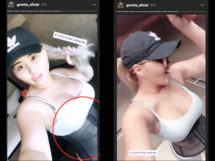 Gomita usa faja a pesar de sus cirugías