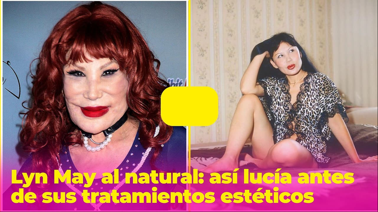 Lyn May al natural: así lucía la vedette antes de sus tratamientos estéticos
