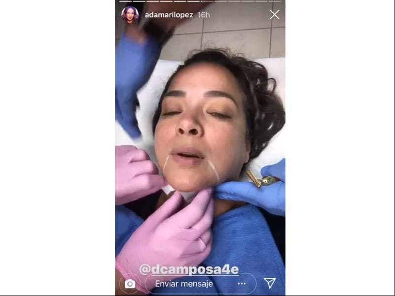 Adamari López explicó en proceso estético en sus redes sociales