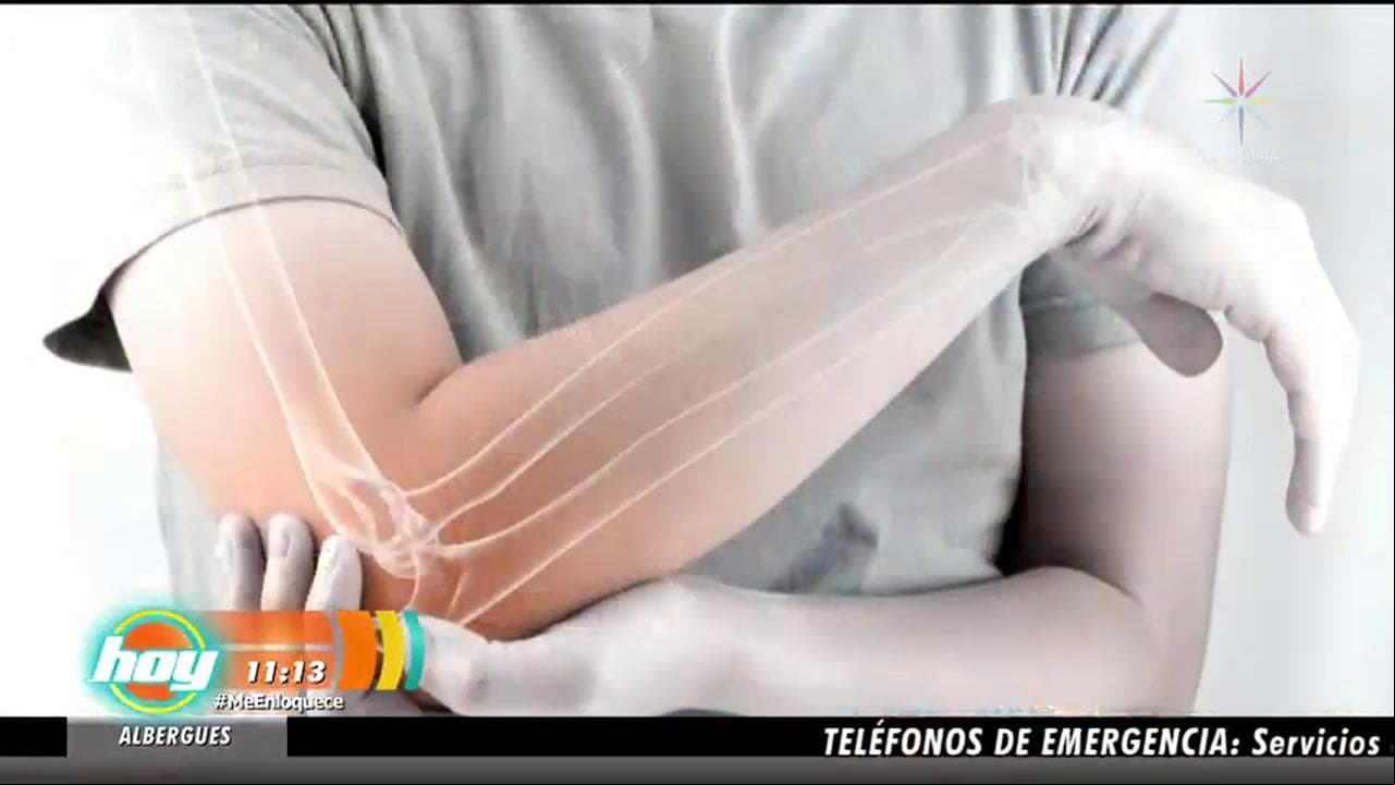 Descubre cómo prevenir la Osteoporosis