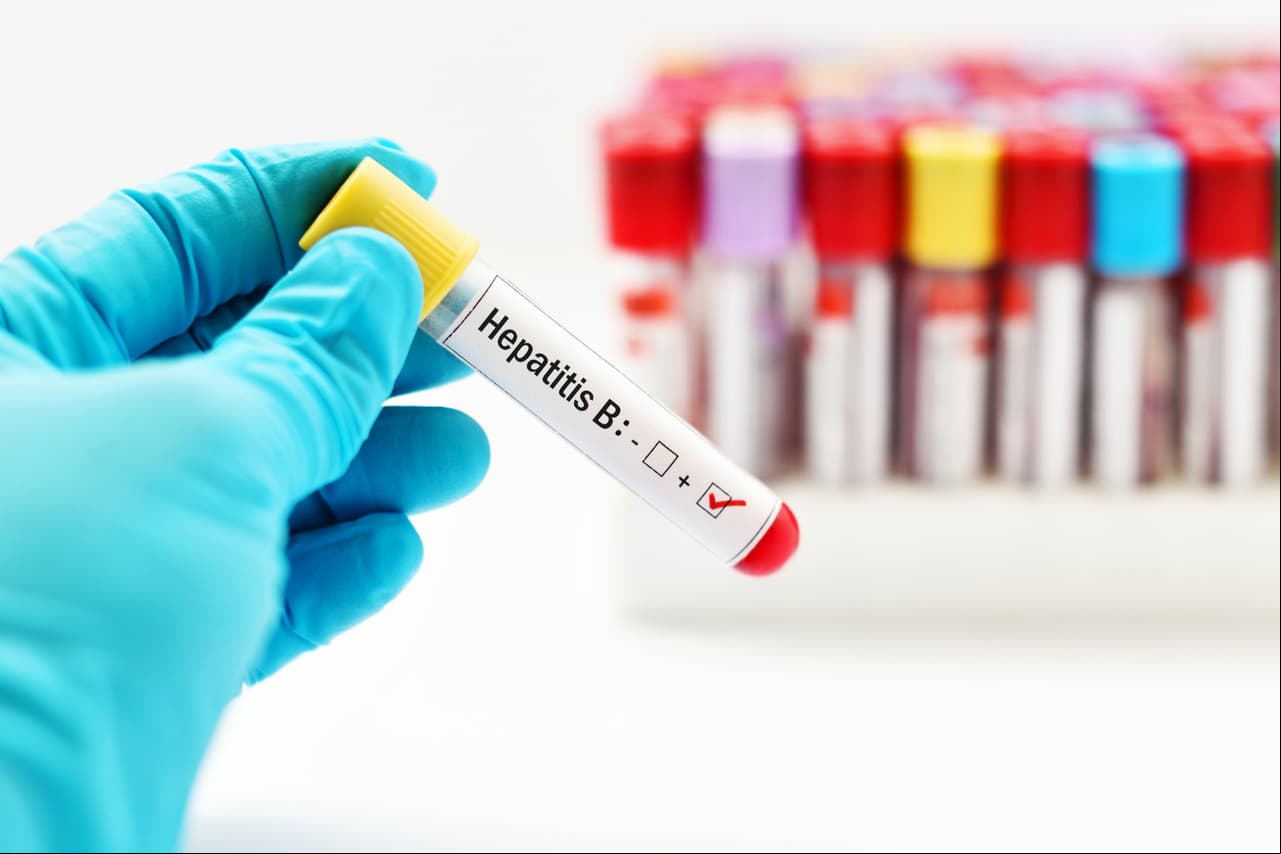 Hepatitis B. Se contagia por el o con la sangre, semen u otro líquido que provenga de una persona infectada.