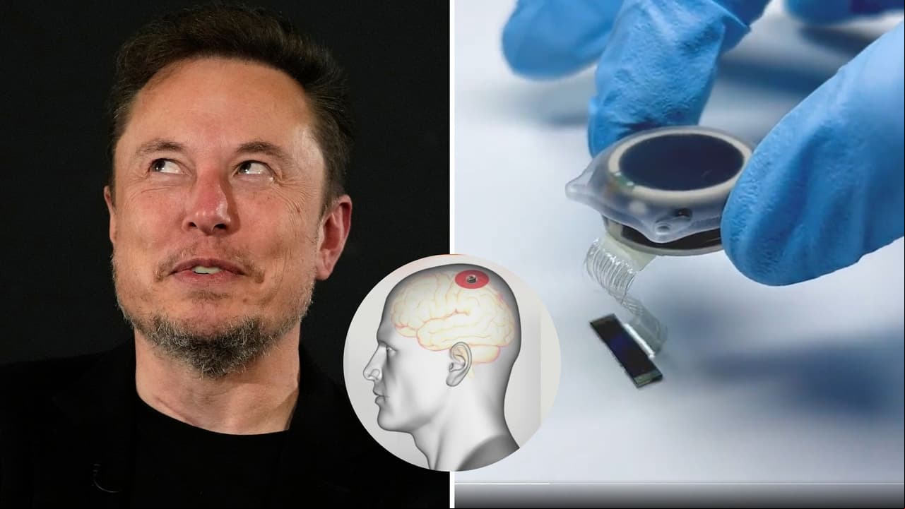 Elon Musk anuncia que su empresa Neuralink ya implantó el primer chip cerebral en un humano
