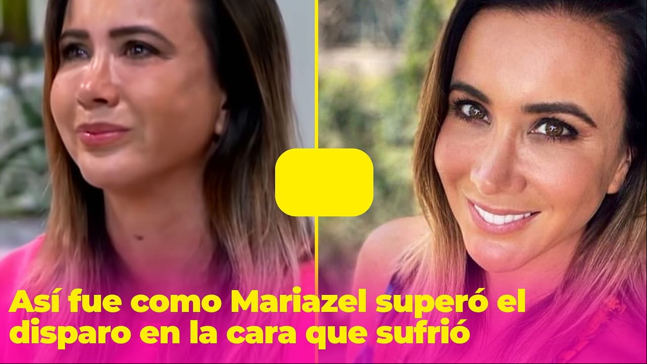 Mariazel no ha tenido una vida fácil: sufrió un disparo en la cara tras un intento de secuestro