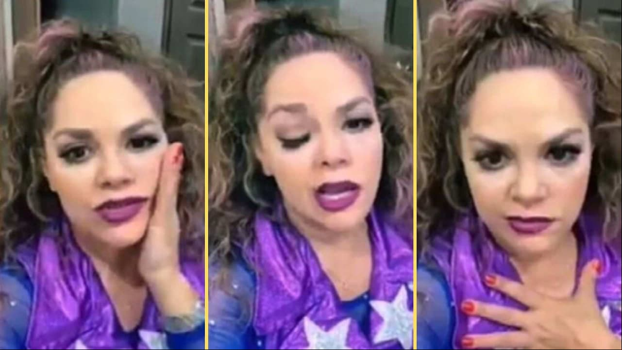 VIDEO: Tatiana sufre de una parálisis facial que le impide mover el lado derecho de su rostro