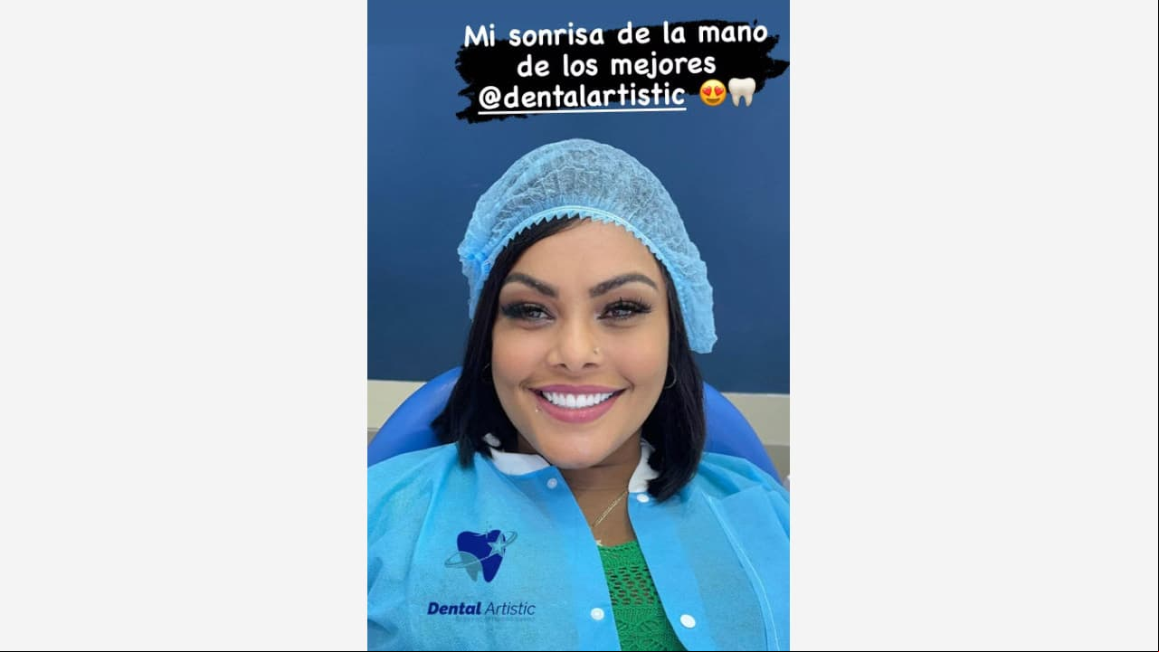 Wanda Díaz presume su nueva sonrisa