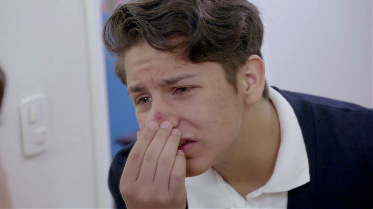 ESTE MARTES: Remedios para el acné por internet
