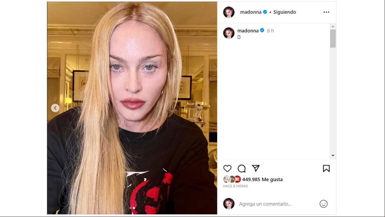 Madonna reapareció en redes sociales en medio de su recuperación.