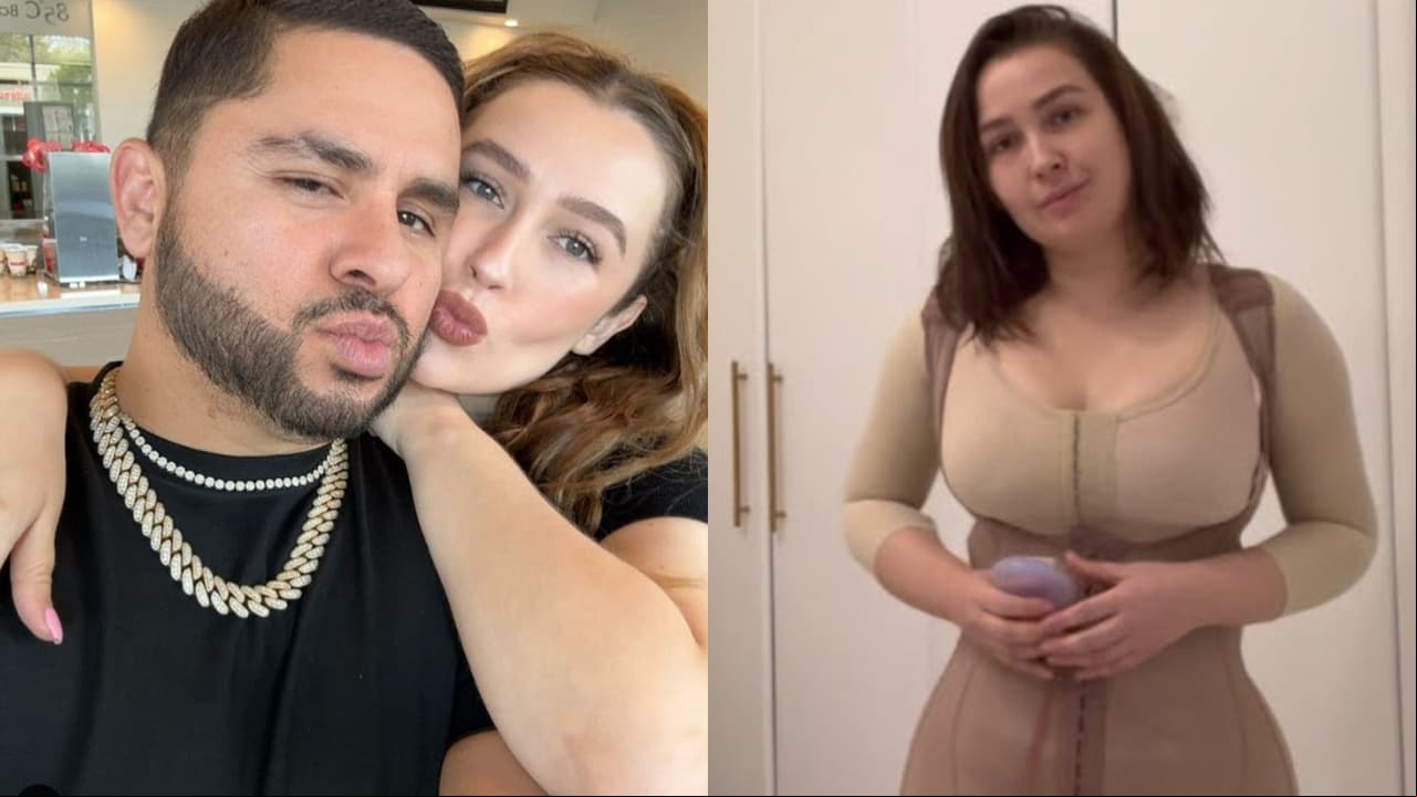 Larry Hernández habla del (¿fallido?) 'mommy makeover' de su esposa