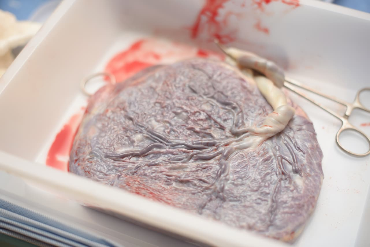 Aunque no hay nada concreto sobre comer placenta, la Universidad de Nevada, destaca que, tiene varios beneficios.
