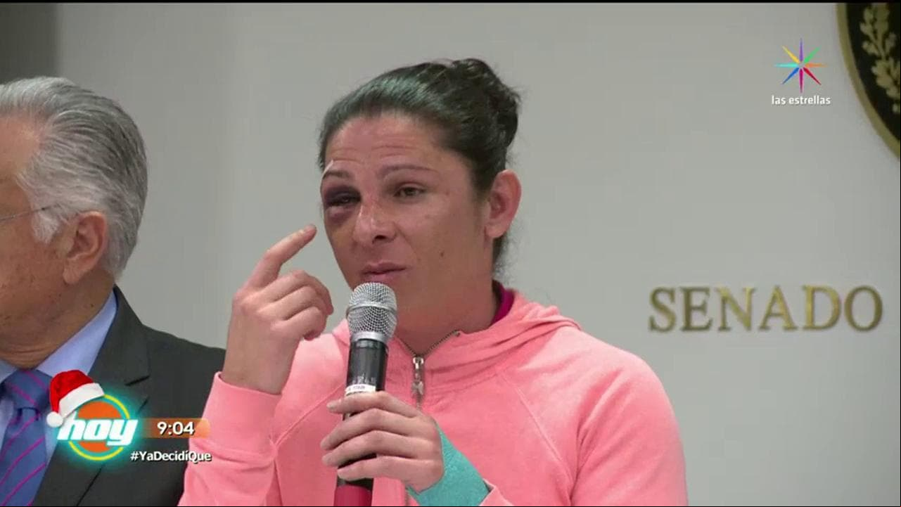 VIDEO: ¡Ana Gabriela Guevara habla sobre el ataque que sufrió!