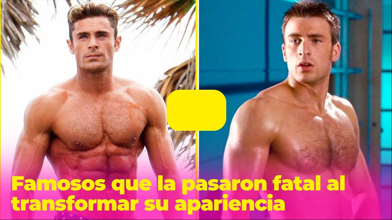 Famosos que querían lucir perfectos, pero la pasaron fatal cuando transformaron su cuerpo