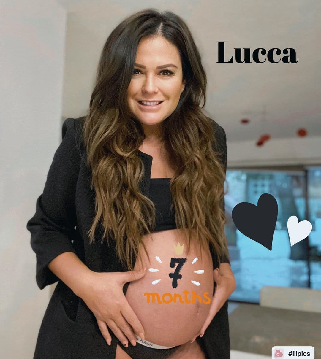 ¿Qué riesgos corre una embarazada al ser operada por apendicitis, como Mariana Echeverría?
