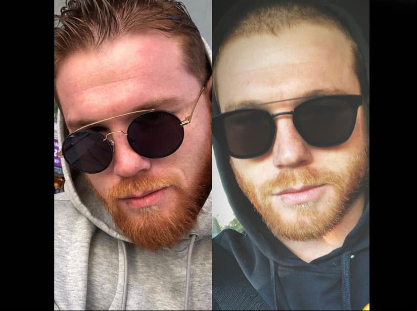 'Canelo' se rapa y lo muestra en redes
