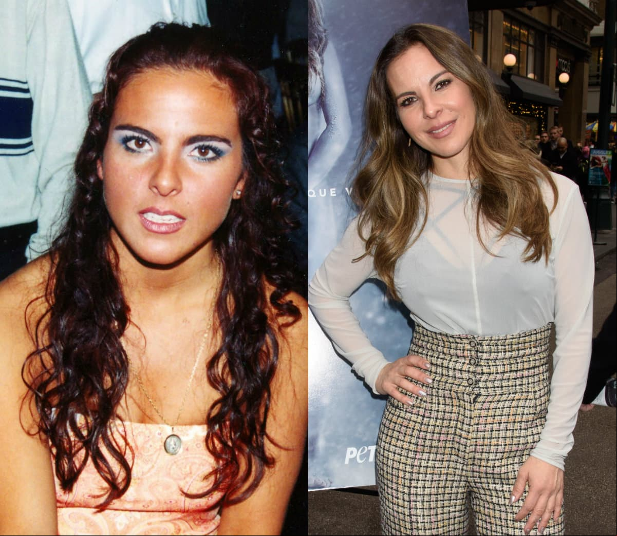 Entre los tratamientos estéticos que aseguran se realiza Kate del Castillo están las inyecciones de botox