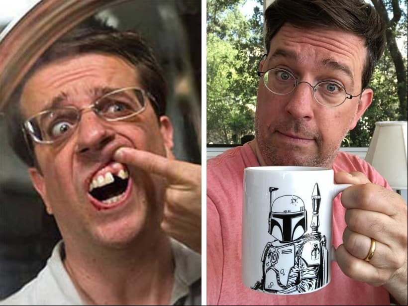 Ed Helms. Aunque no perdió ninguno, al actor le hace falta un diente debido a una deformidad genética, por lo cual ha llevado un implante desde que cumplió 15 años. Sin embargo, en 2009 decidió quitarlo para la película “¿Qué paso ayer?”.