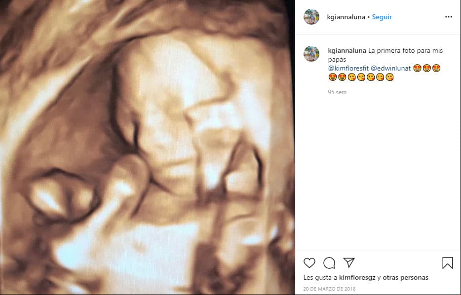La pequeña nació el 16 de julio de 2018; sin embargo, desde cuatro meses antes de su llegada, sus papás abrieron su cuenta oficial de Instagram donde presumieron la primera foto.