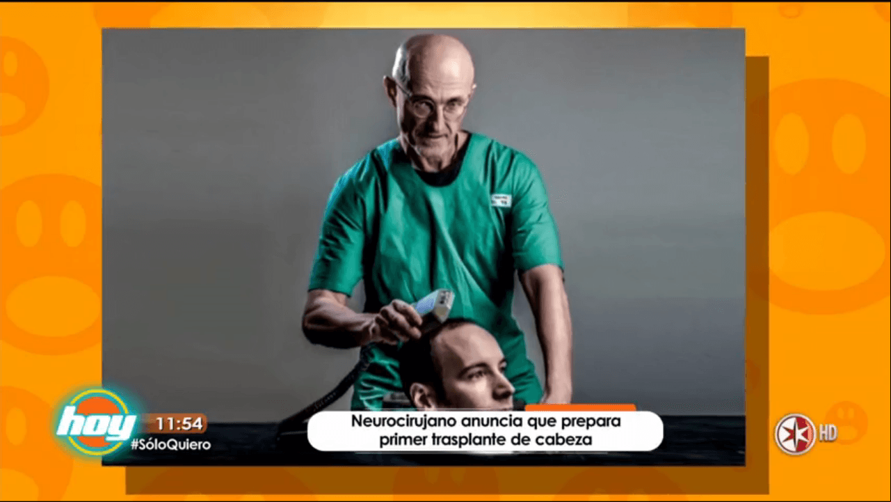 ¡Omaigá! médico busca realizar el primer trasplante de cabeza