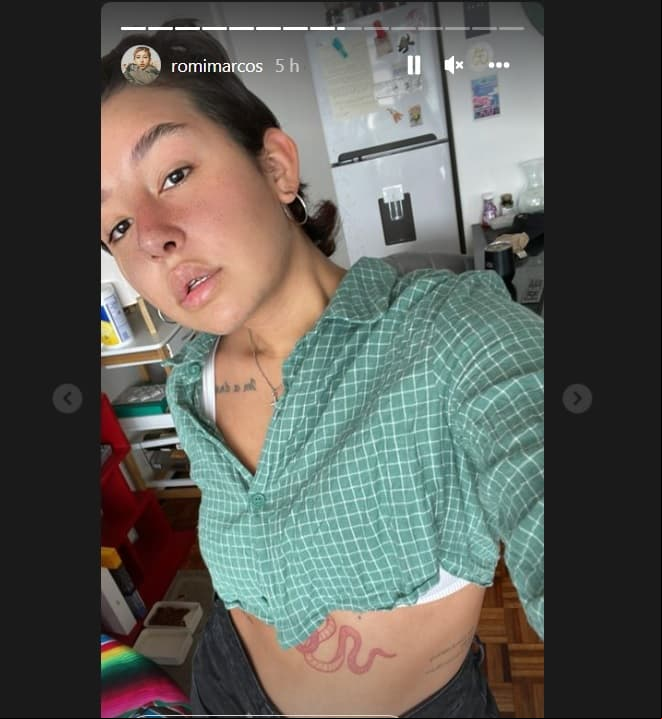 Así luce Romi Marcos tras cirugía