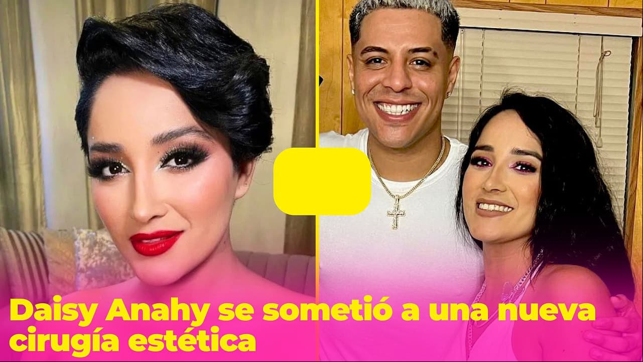 Daisy Anahy impacta con su transformación: se hizo nueva cirugía estética