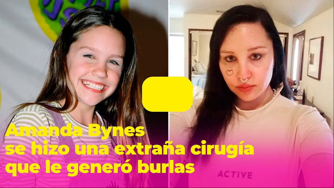 ¿Qué le pasó a Amanda Bynes en el rostro? Una extraña cirugía le cambió la cara