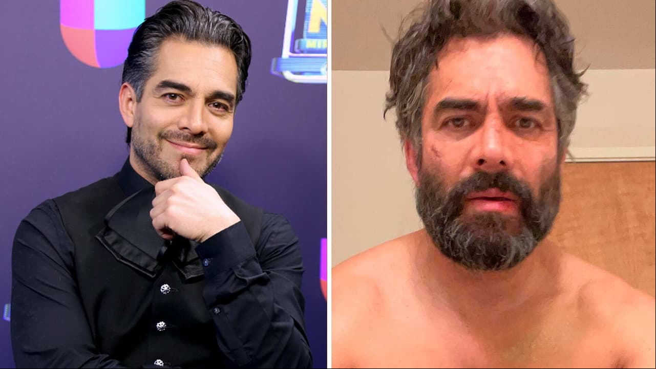 Omar Chaparro luce irreconocible; muestra el antes y después