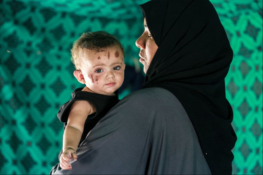 La niña palestina Rim Abu Hayya, única sobreviviente de su familia después de que murieran en un bombardeo israelí que alcanzó su casa en el este de Khan Yunis, es llevada por su tía Ayat en un refugio de tiendas de campaña al oeste de Khan Yunis, en el sur de la Franja de Gaza, el 13 de agosto de 2024.