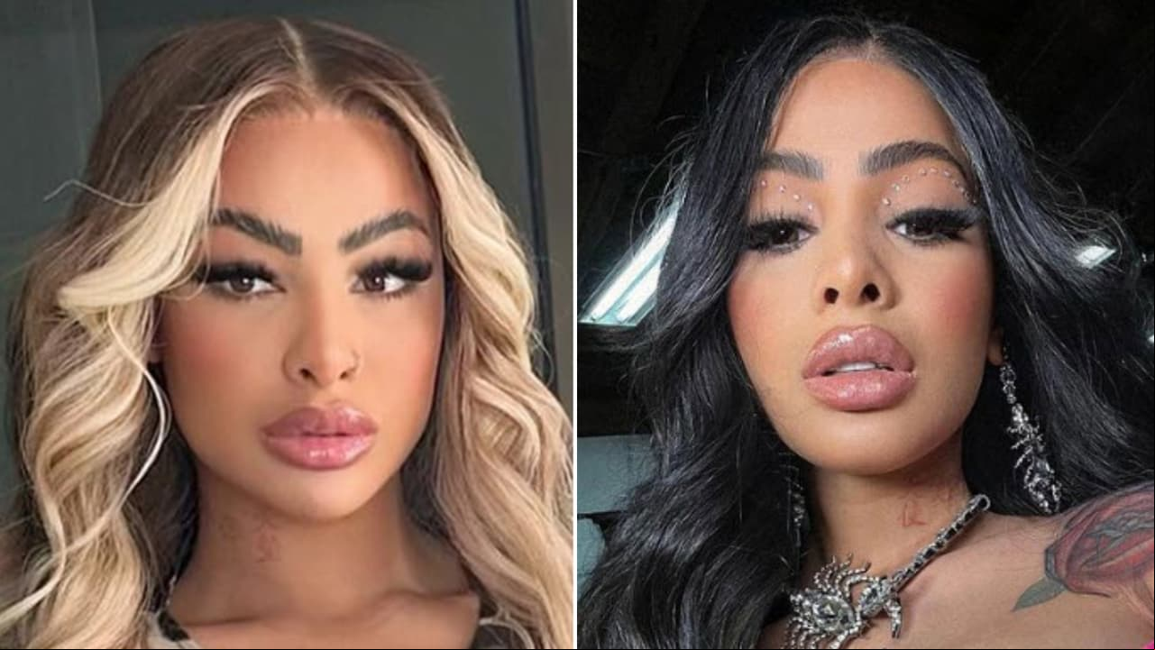 Circula foto de Yailin herida y con golpes en la cara: esto se sabe