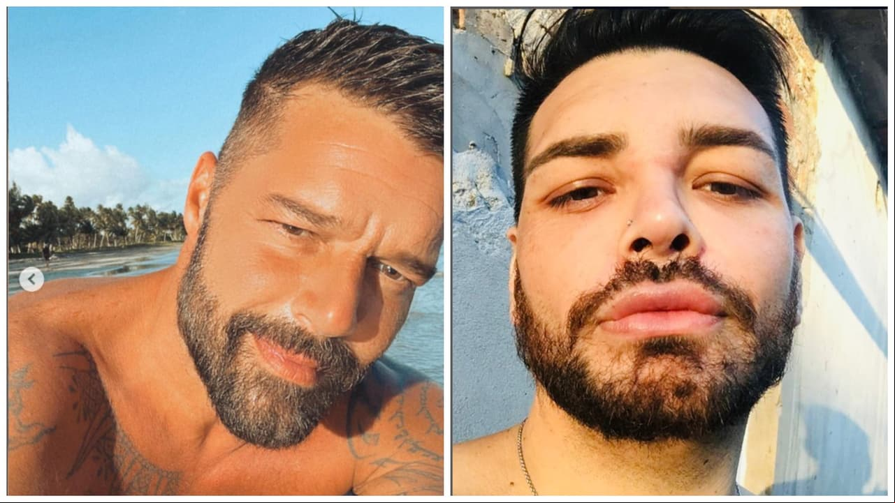 Un joven se sometió a 30 cirugías para parecerse a Ricky Martin.