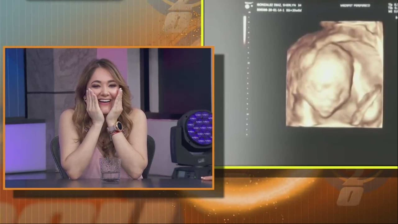 ¡Ya se dejó ver!: Sherlyn confiesa que ya sabe cuál es el sexo de su bebé