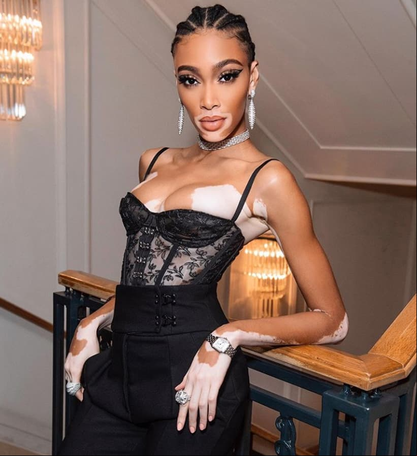 Además de las pasarelas y portadas de revistas, Winnie ha aparecido en varios videos musicales, incluyendo ‘The one’ de JMSN, ‘Guts over fear’ de Eminem y ‘Where is the love?’ de The Black eyed peas.