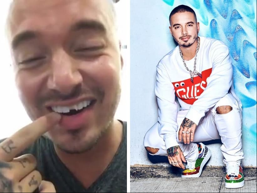J Balvin. En 2016 el cantante colombiano cayó de una caminadora, lo que provocó que se le rompiera uno de sus dientes.